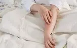 چرا خاراندن بدن ، حس خوبی ایجاد می کند؟