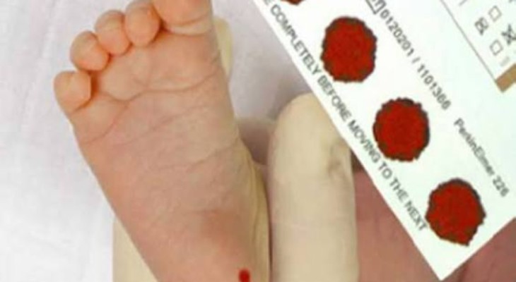 غربالگری ۶۵۴ نوزاد در بیجار انجام شد